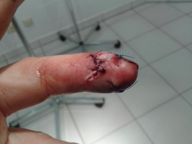 K800_Finger.JPG