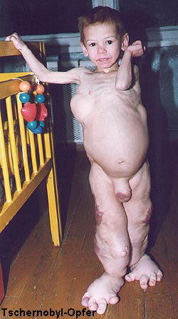 tschernobyl-opfer.jpg
