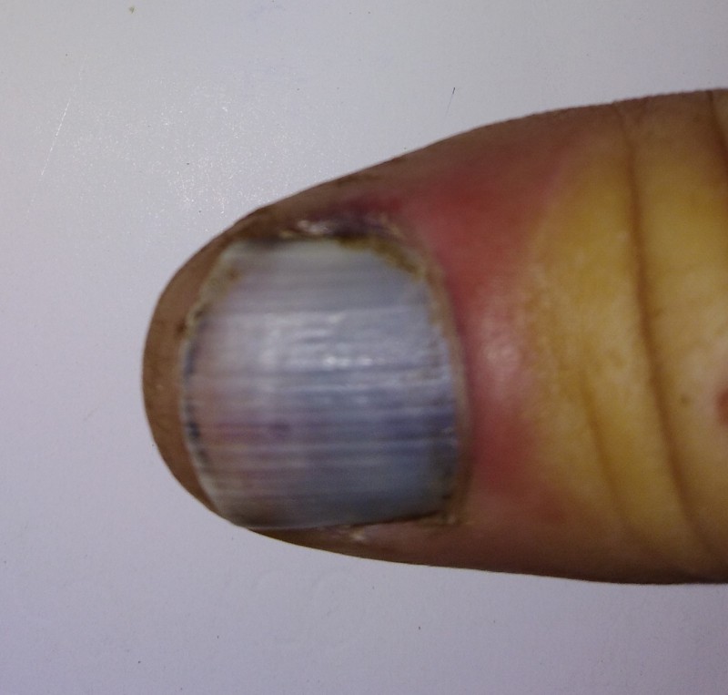 IMG_20180702_180823 (2).jpg